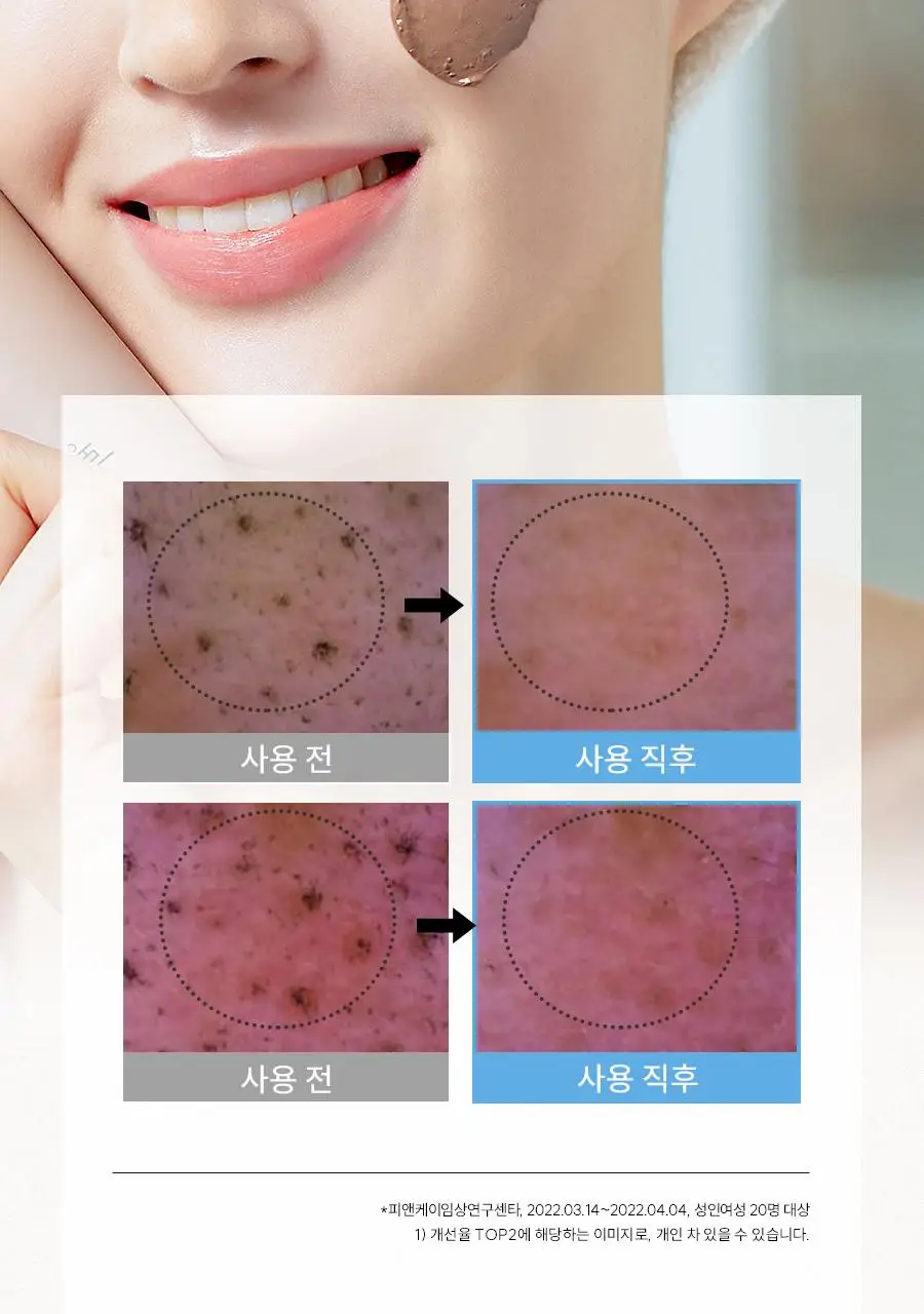 [모공쫀쫀]한율 부들밤 말끔/깔끔 모공팩 100ml (15ml+모공패드 4매)기획 택1 상세페이지 17